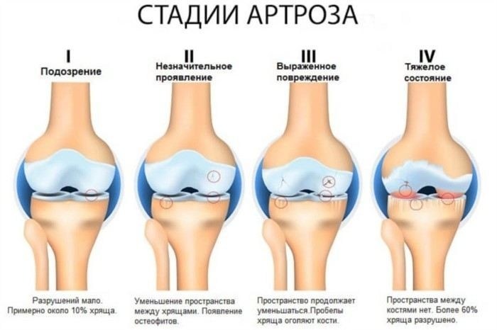Какие медицинские документы нужны для освидетельствования при артрите?