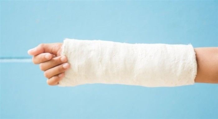 Советы для прогулки с гипсом на руке: как избежать осложнений