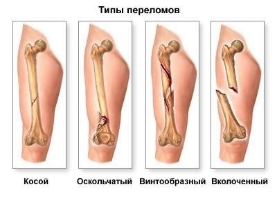 Классификация внутренних травм и их влияние на здоровье