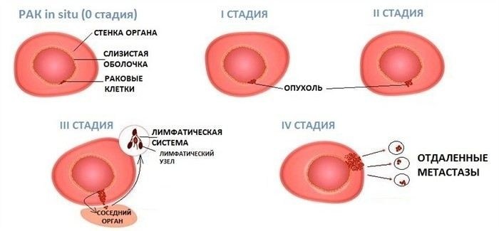 Как расшифровывать медицинские заключения после травм бойцов